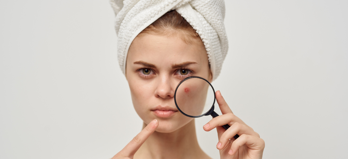 Woman with towel on head examining acne with magnifying glass before using Primabiotic Collagen