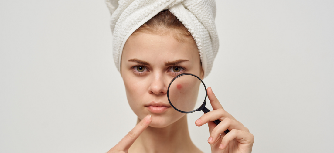 Woman with towel on head examining acne with magnifying glass before using Primabiotic Collagen