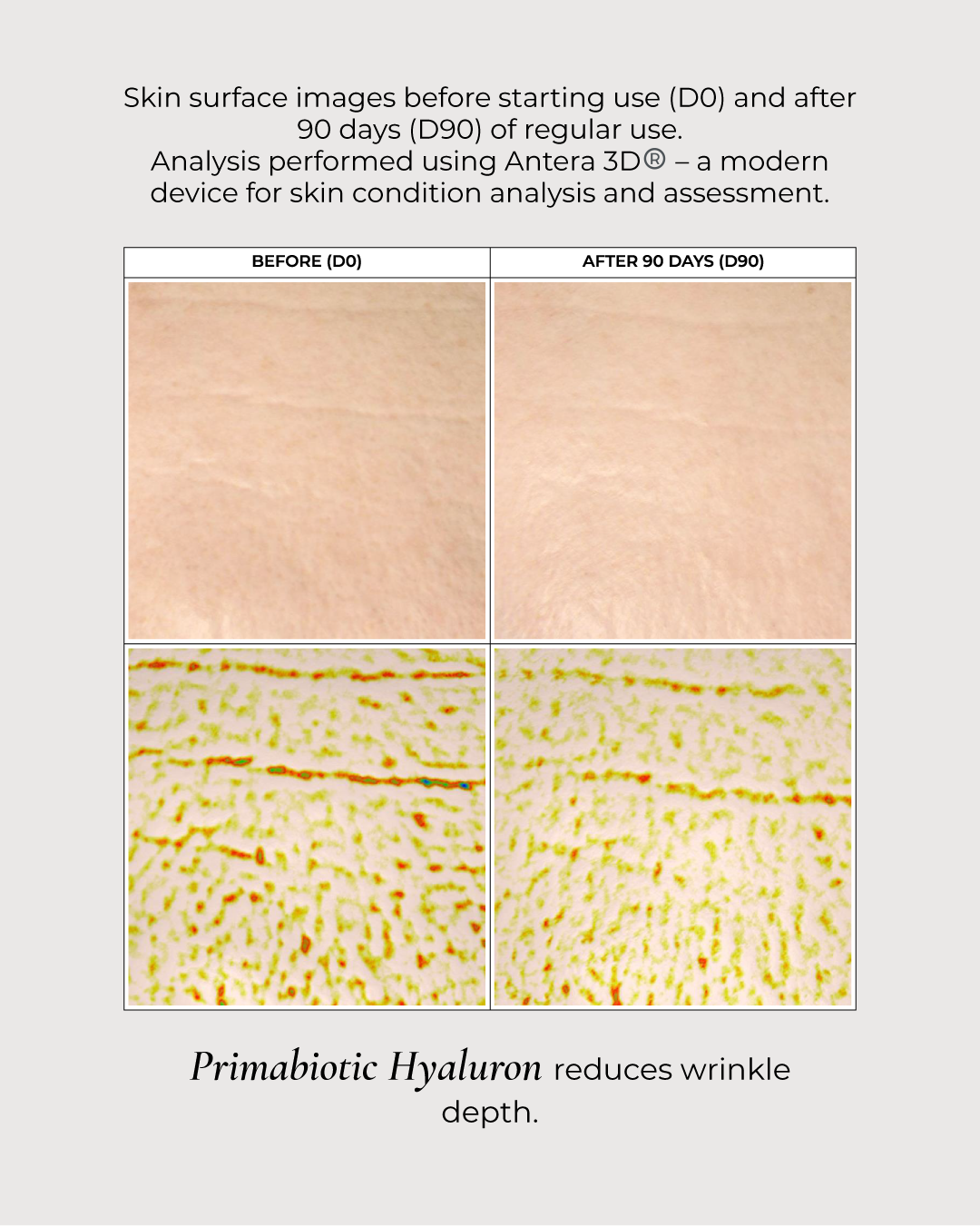 Primabiotic Hyaluron – liquid hyaluronic acid supplement
