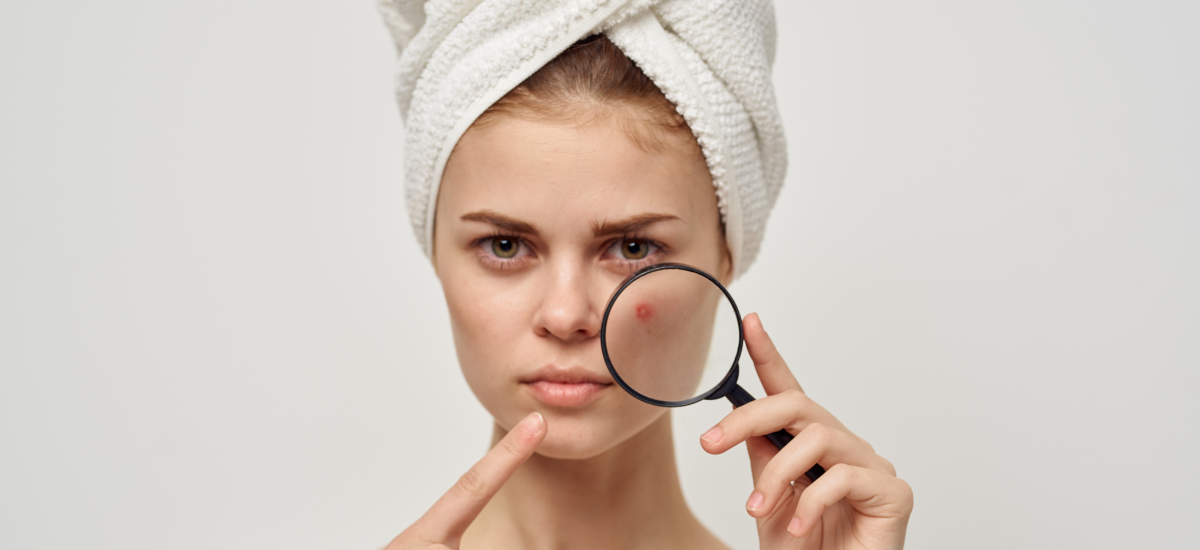 Does Collagen Help Cure Acne Uk