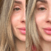 collagen before and after