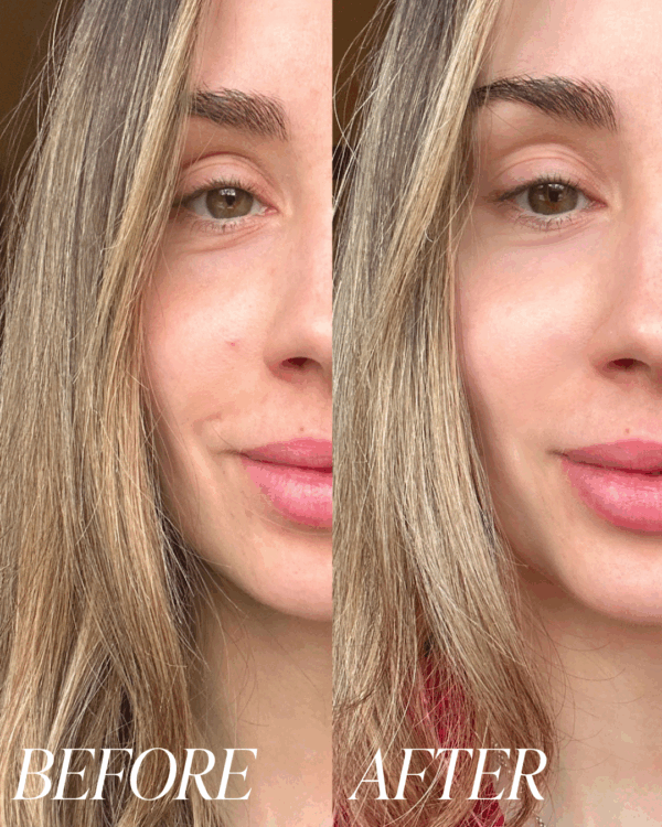 collagen before and after