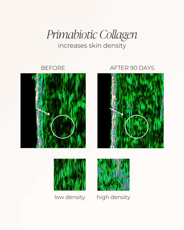 collagen effects