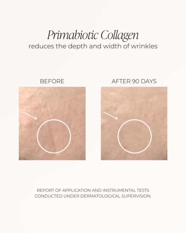 collagen effects
