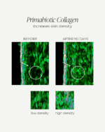 collagen effects
