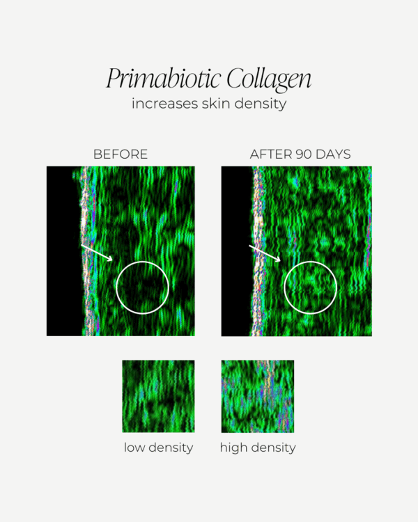 collagen effects