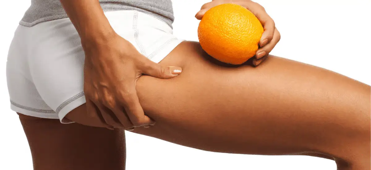 A woman holds oranges and crinkles the skin on her thigh with her other hand